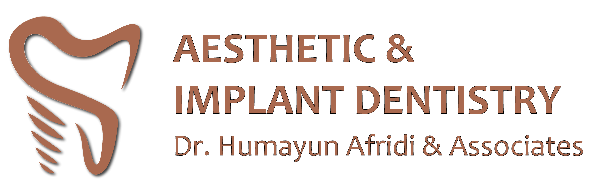 Aesthetic Dental Implant Aesthetic Dental Implant